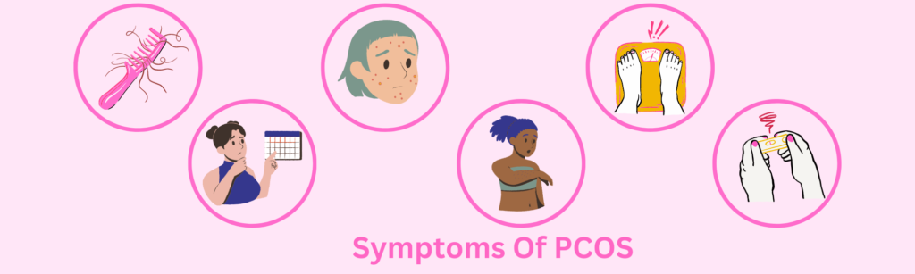 Symptoms Of PCOS